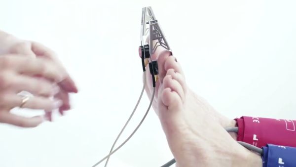 vascular screening oabi pwi topp