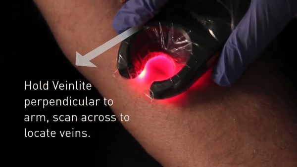 veinlite led vein finder demo