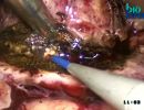 biolitec r medical laser